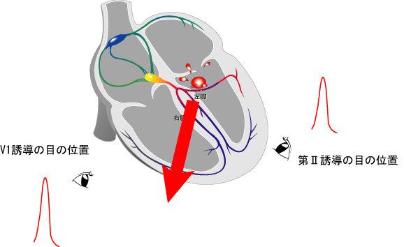 心室期外収縮の出現部位と興奮伝播の関係